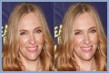 Toni Collette Teeth Before And After | What Is Wrong With Her Face